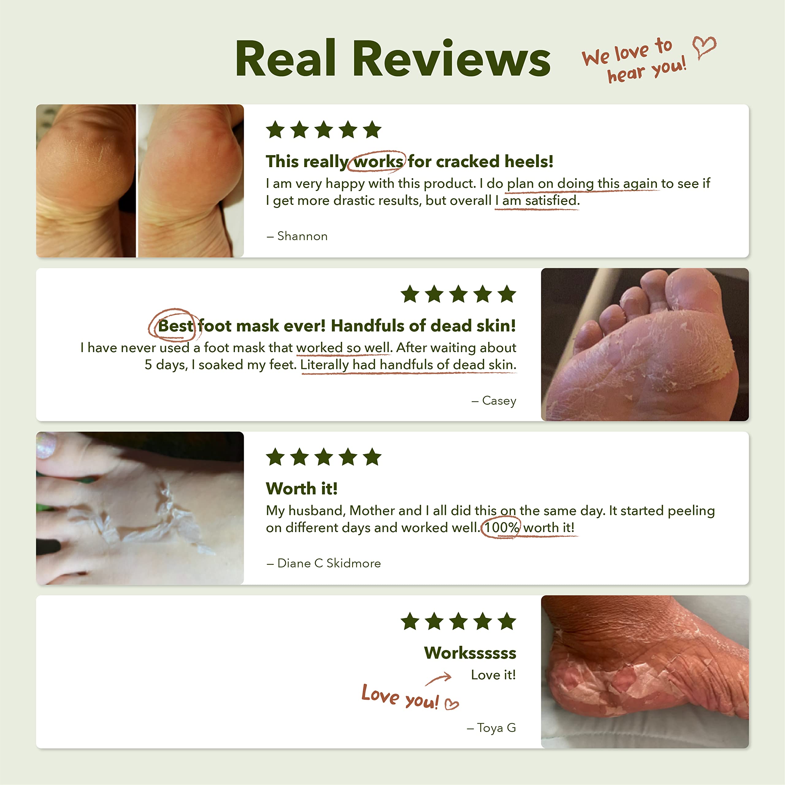 Purederm Shiny Soft Foot Mask after use closeup showing nourished appearance
