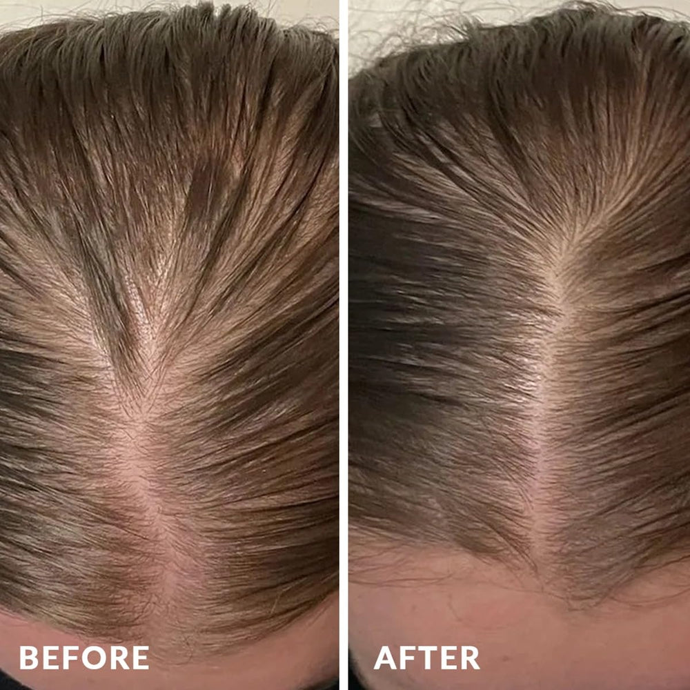 PureNaturis fermented rice water dropper highlighting traditional ingredient for scalp nourishment