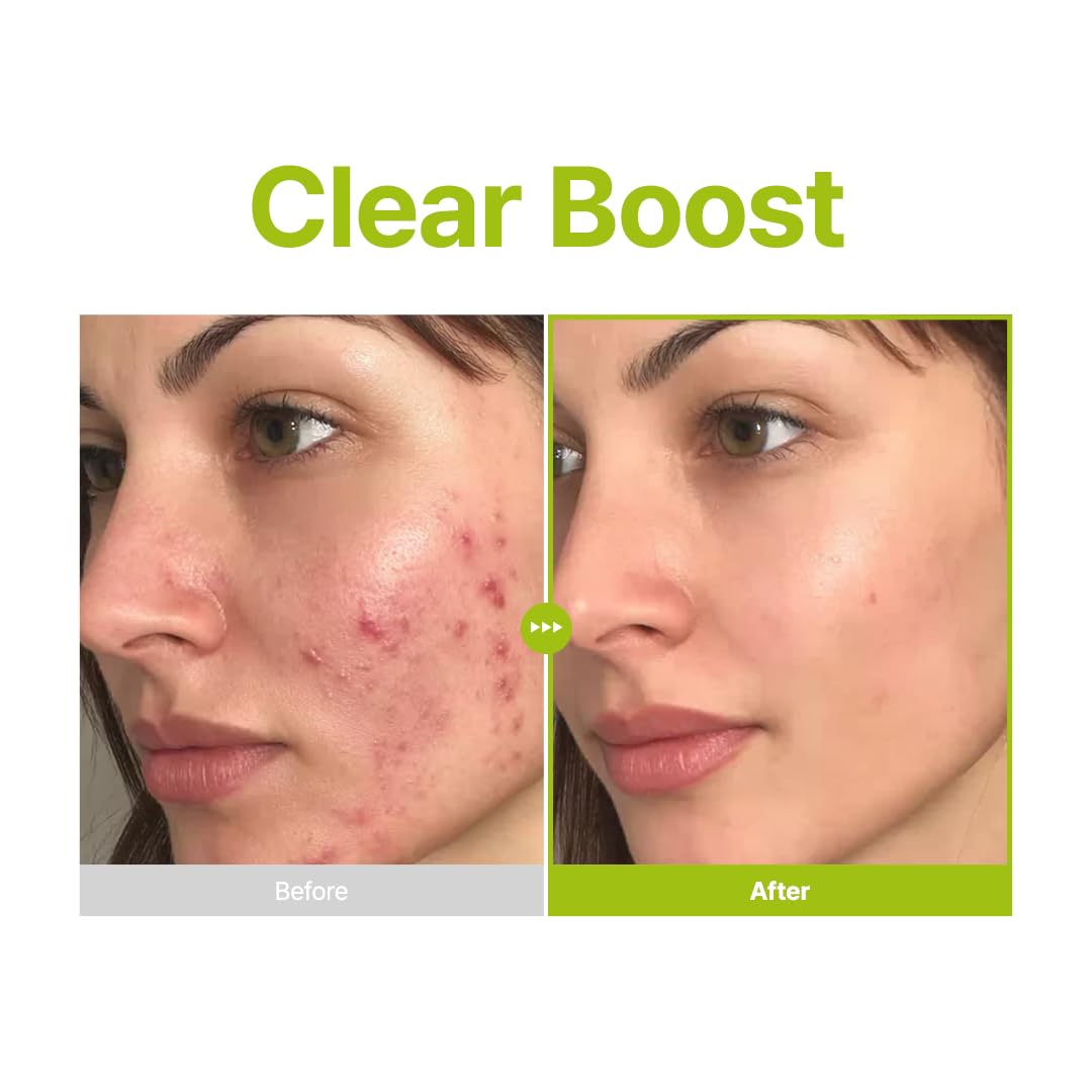 Purito ingredients panel featuring azelaic, kojic, and tea tree components