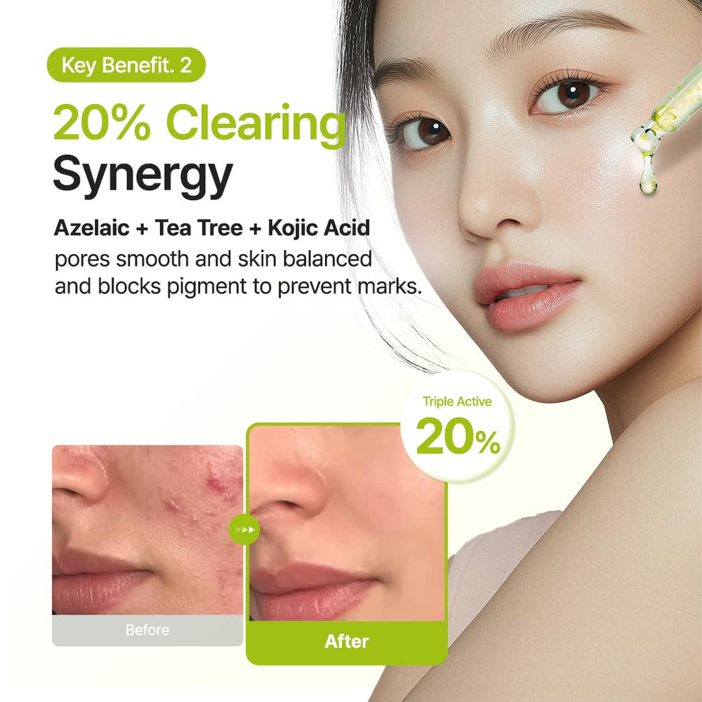 Purito tea tree oil capsules detail for refreshing post-cleanse feel