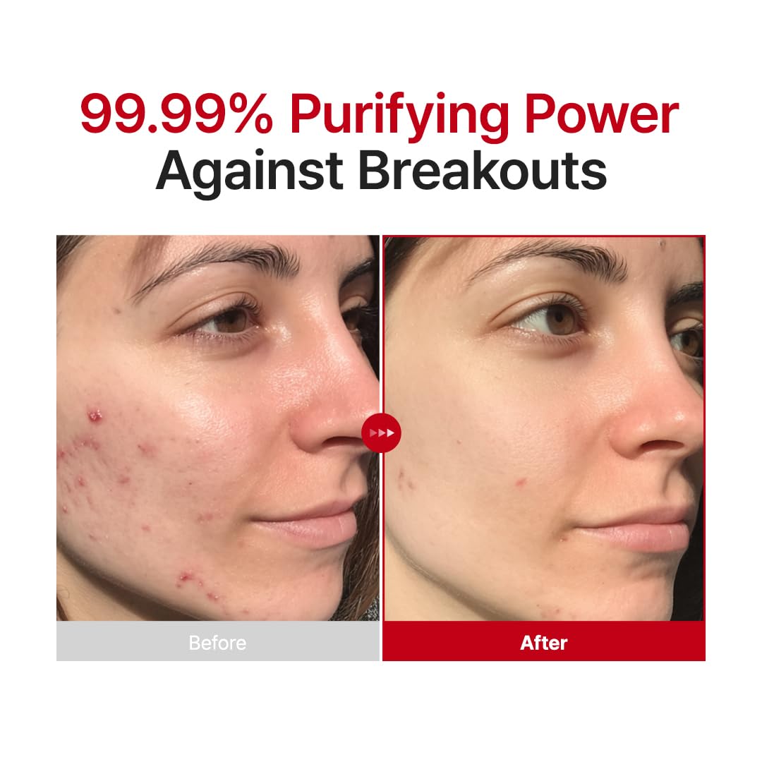 Purito brume apaisante visage : calme les irritations et sensibles.