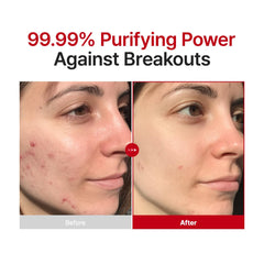 Purito brume apaisante visage : calme les irritations et sensibles.