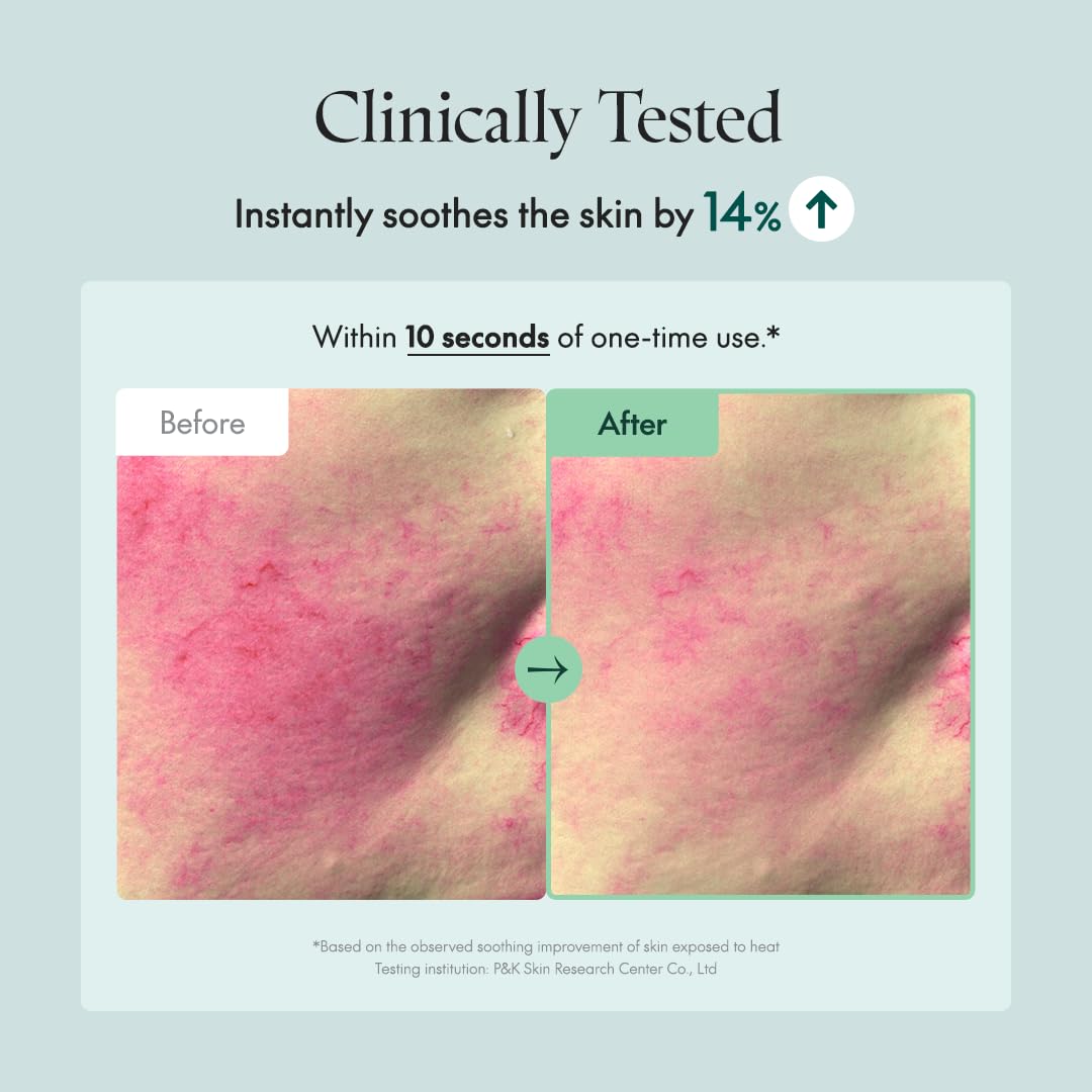 Purito Centella Cream application routine demonstrates gentle, quick-absorb use