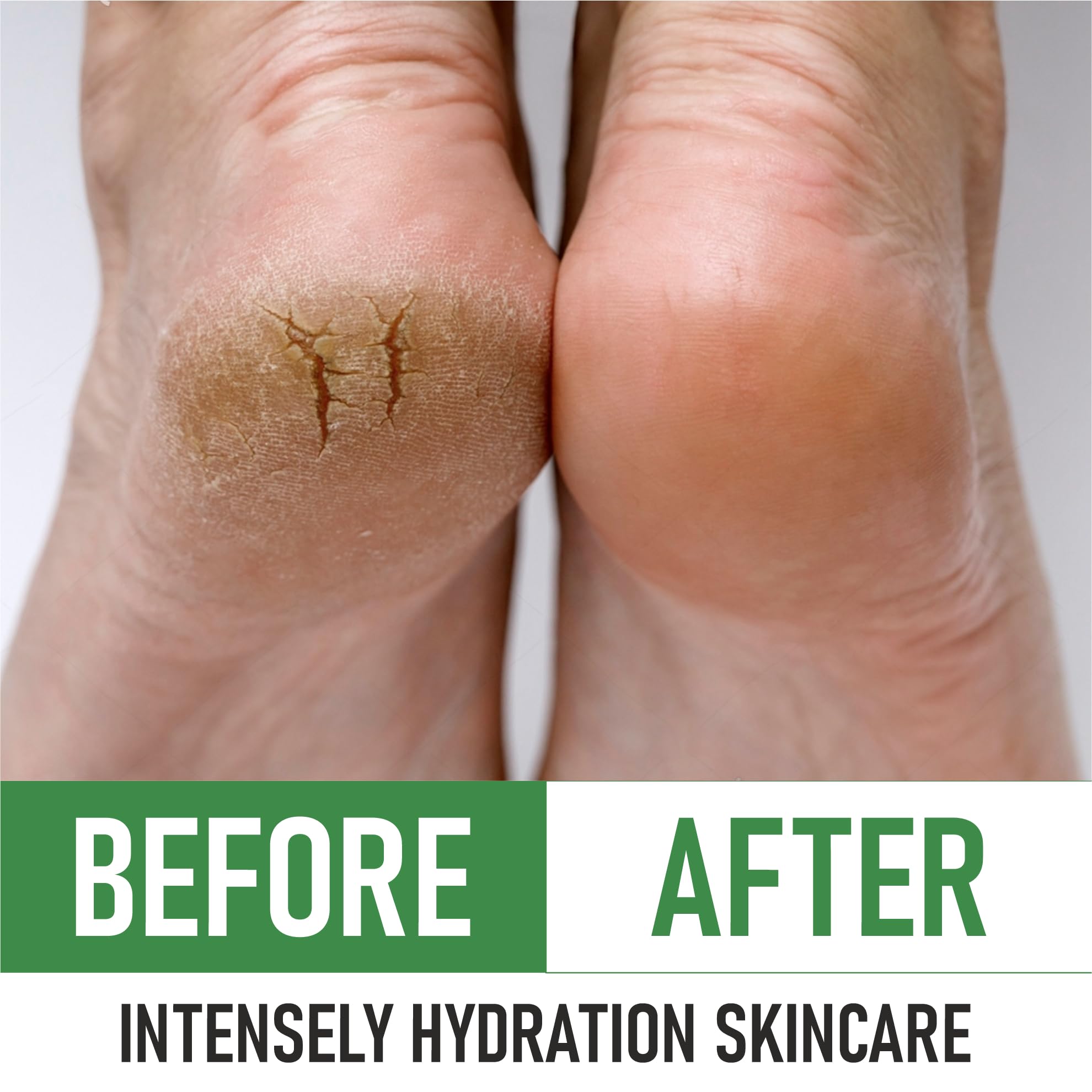 PurOrganica Urea 40% Foot Cream being applied to feet