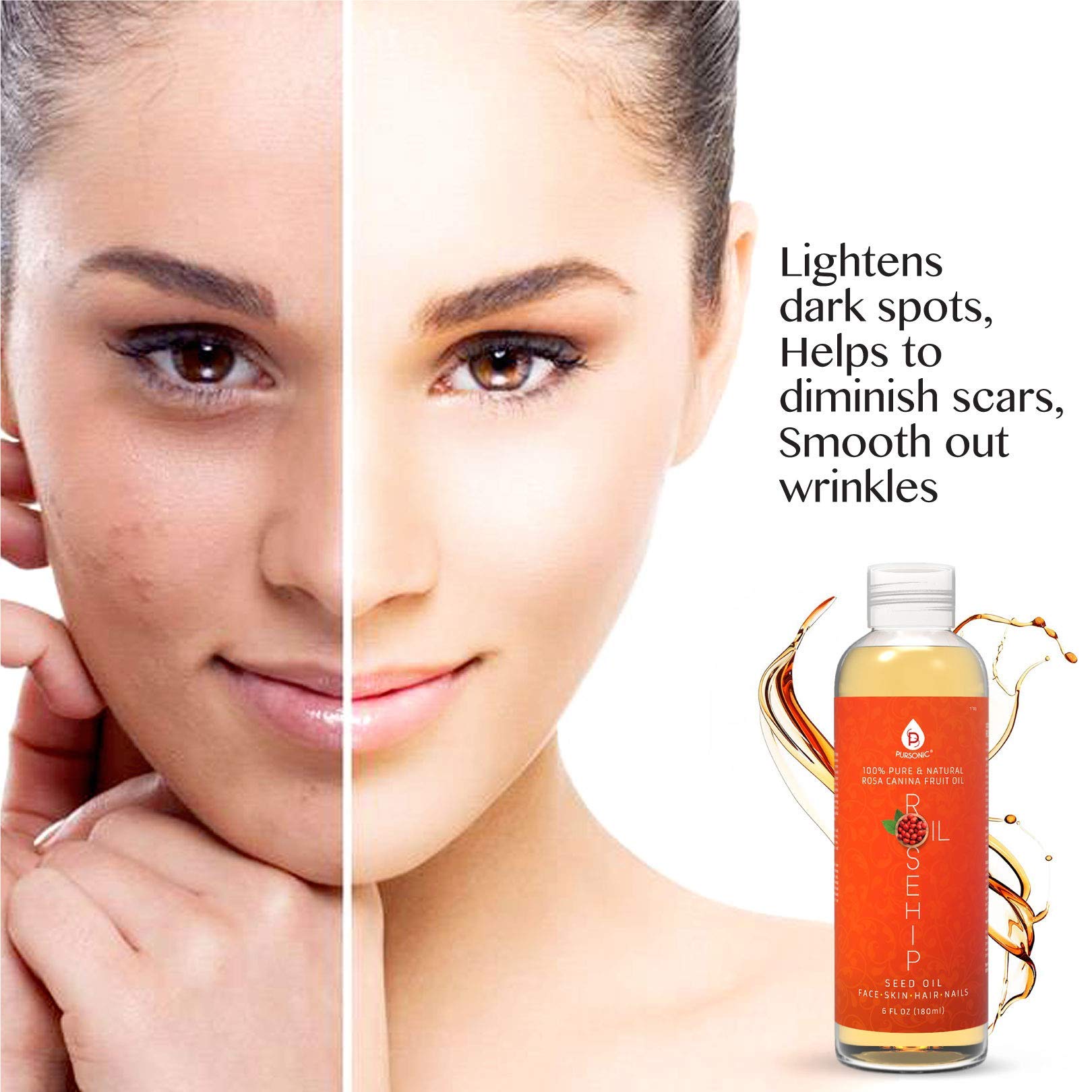 Pursonic Rosehip Oil in skincare routine for face and body