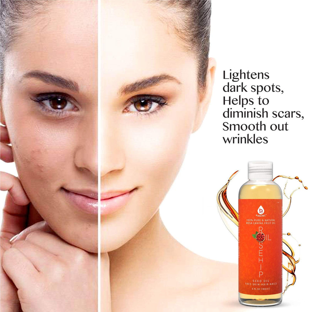 Pursonic Rosehip Oil in skincare routine for face and body