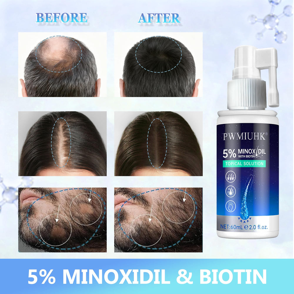 PWMIUHK Minoxidil application on damp hair improves absorption