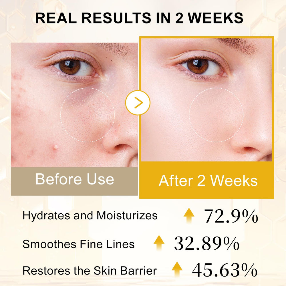 Qgala Bee Venom Serum texture shown for easy spreading.