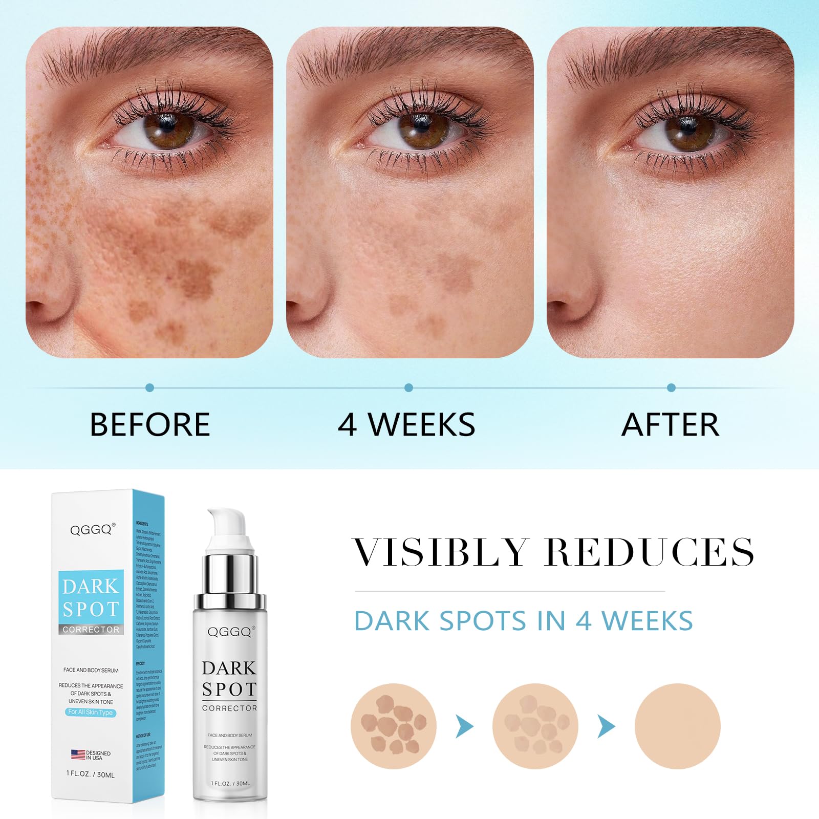 QGGQ packaging image highlights premium serum packaging for hyperpigmentation