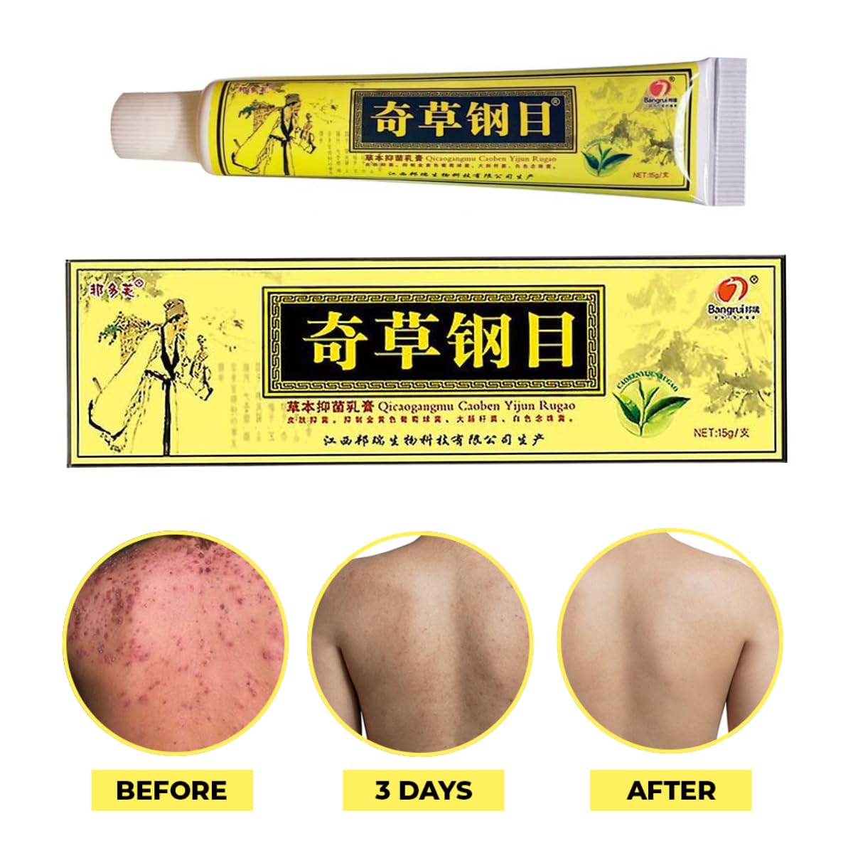QICAOGANGMU Chinese Herbal Cream bottle close-up highlighting a soothing herbal formulation.