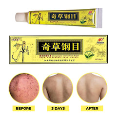 Cream texture on dry skin provides gentle nourishment and relief.