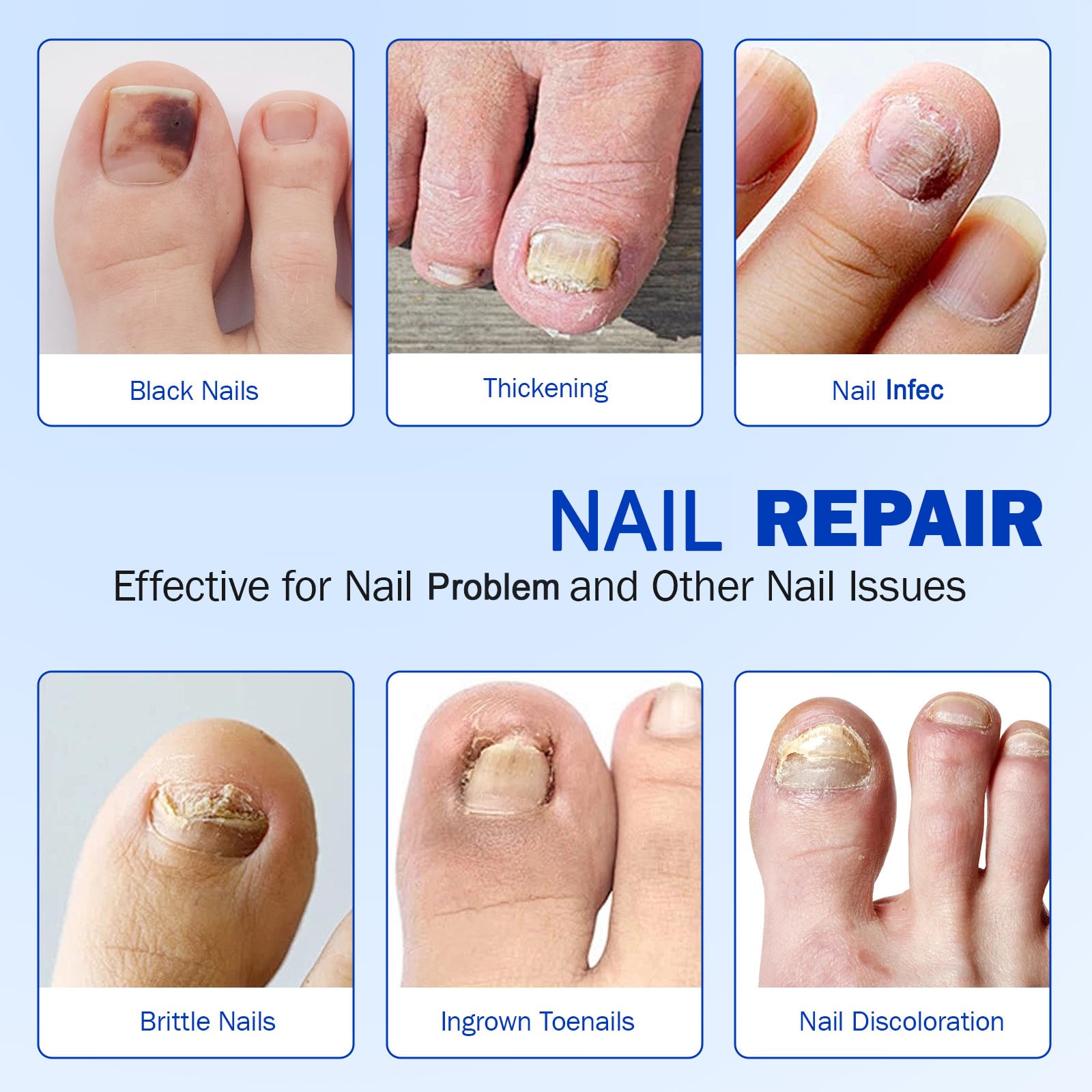 Qing Yo patches on clean, dry nails ready for overnight treatment.