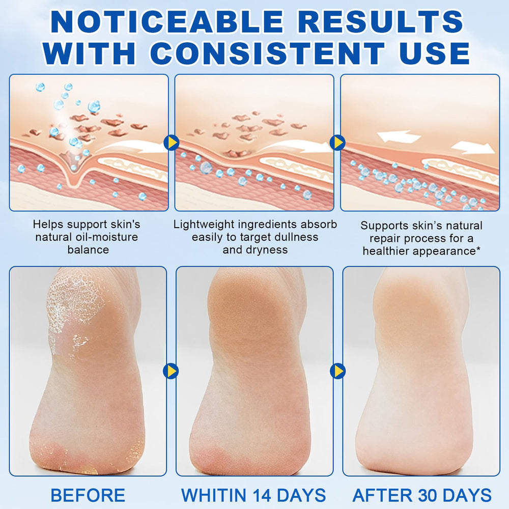 QJCWXIAOX Callus removal softener for smoother feet