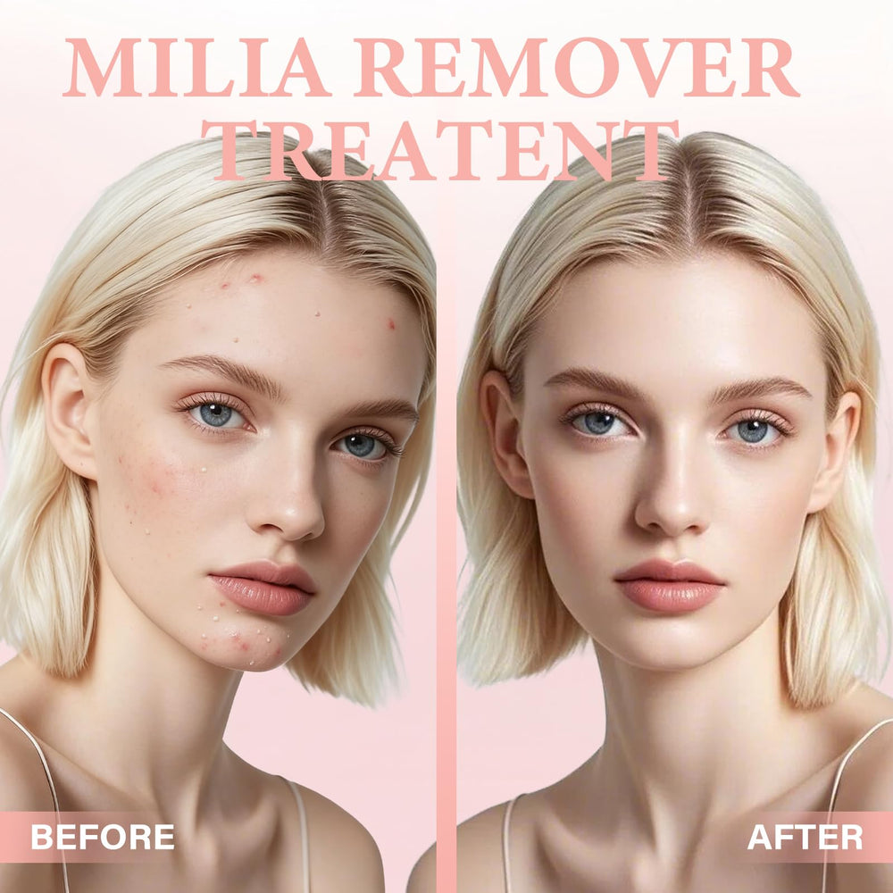 QKDBLWX Milia Remover Serum under makeup layering supports seamless wear.