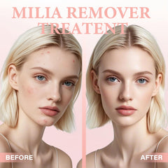 QKDBLWX Milia Remover Serum under makeup layering supports seamless wear.