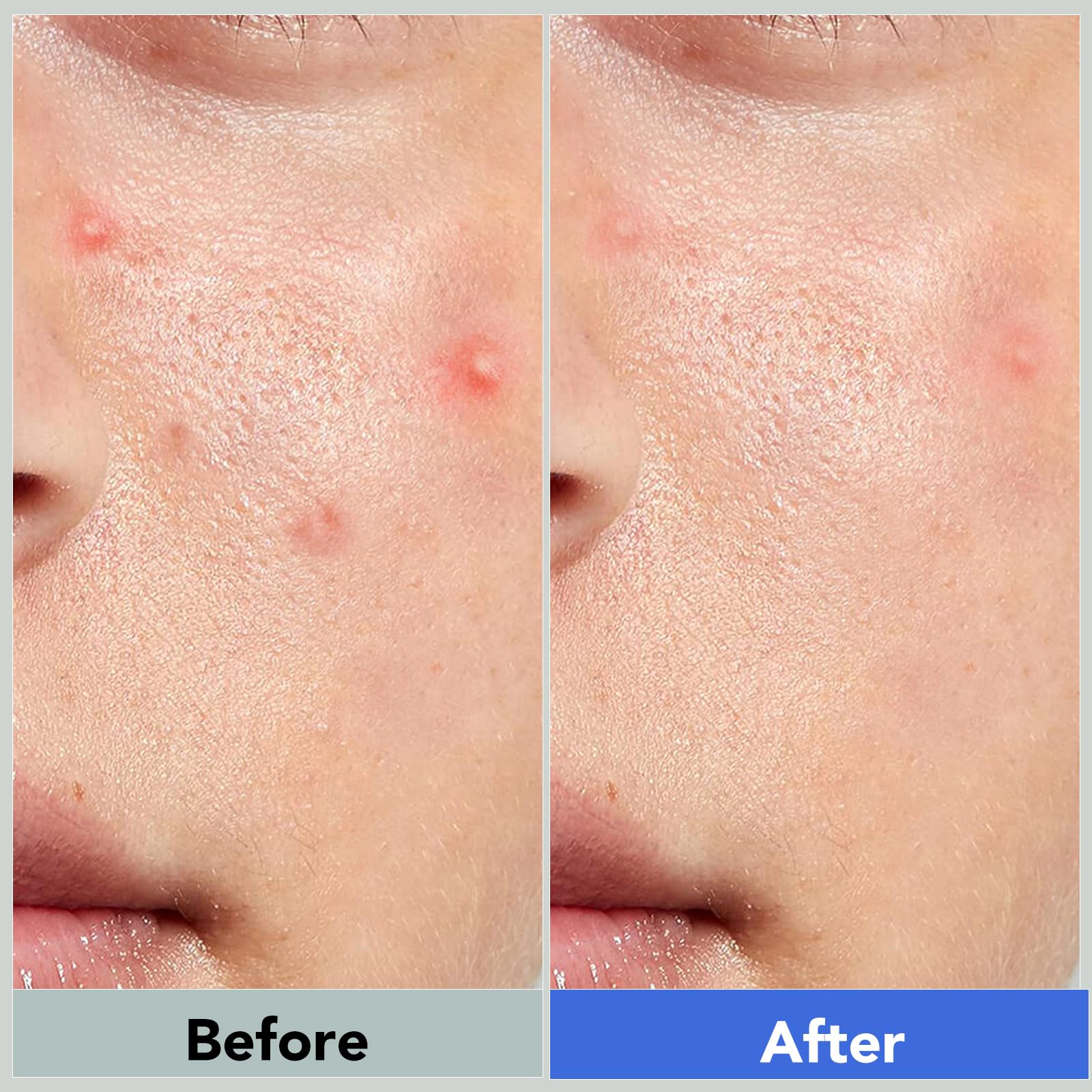 Qmakup patches with strong adhesion that stay in place.