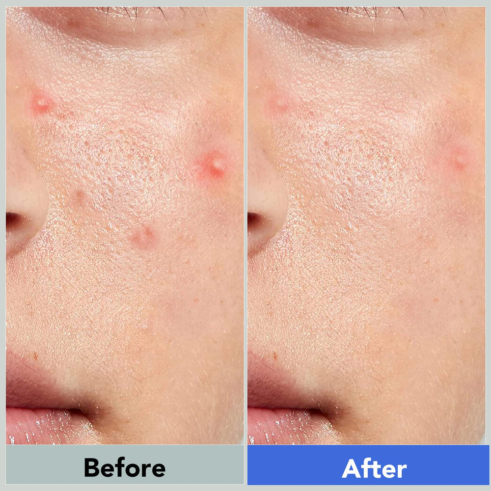 Qmakup patches with strong adhesion that stay in place.