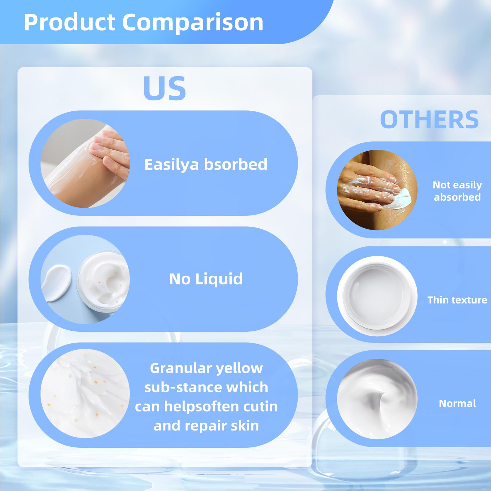 QQWIAX 40% Urea Cream on hand hydrating dry areas