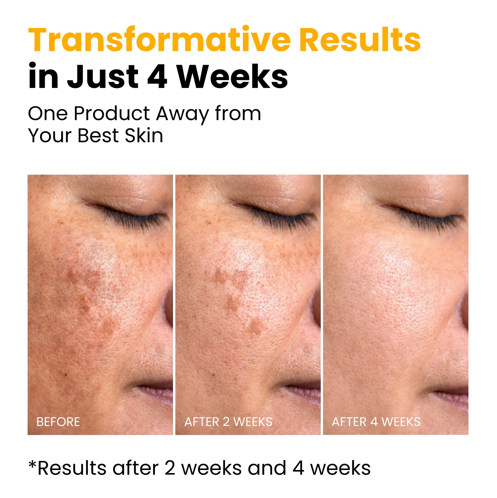 QUIA Beauty Niacinamide + Centella mask supports barrier comfort for stressed skin.