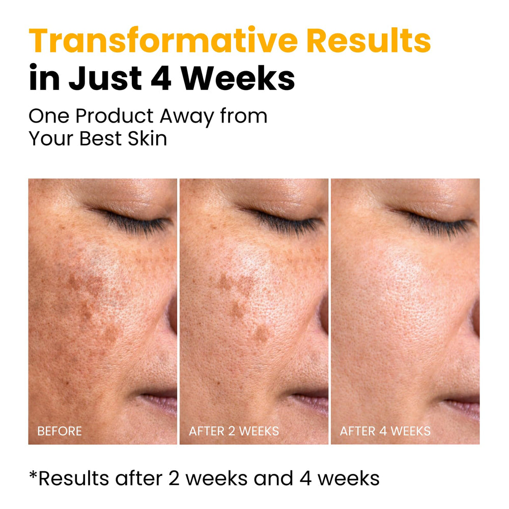 QUIA Beauty Niacinamide + Centella mask supports barrier comfort for stressed skin.