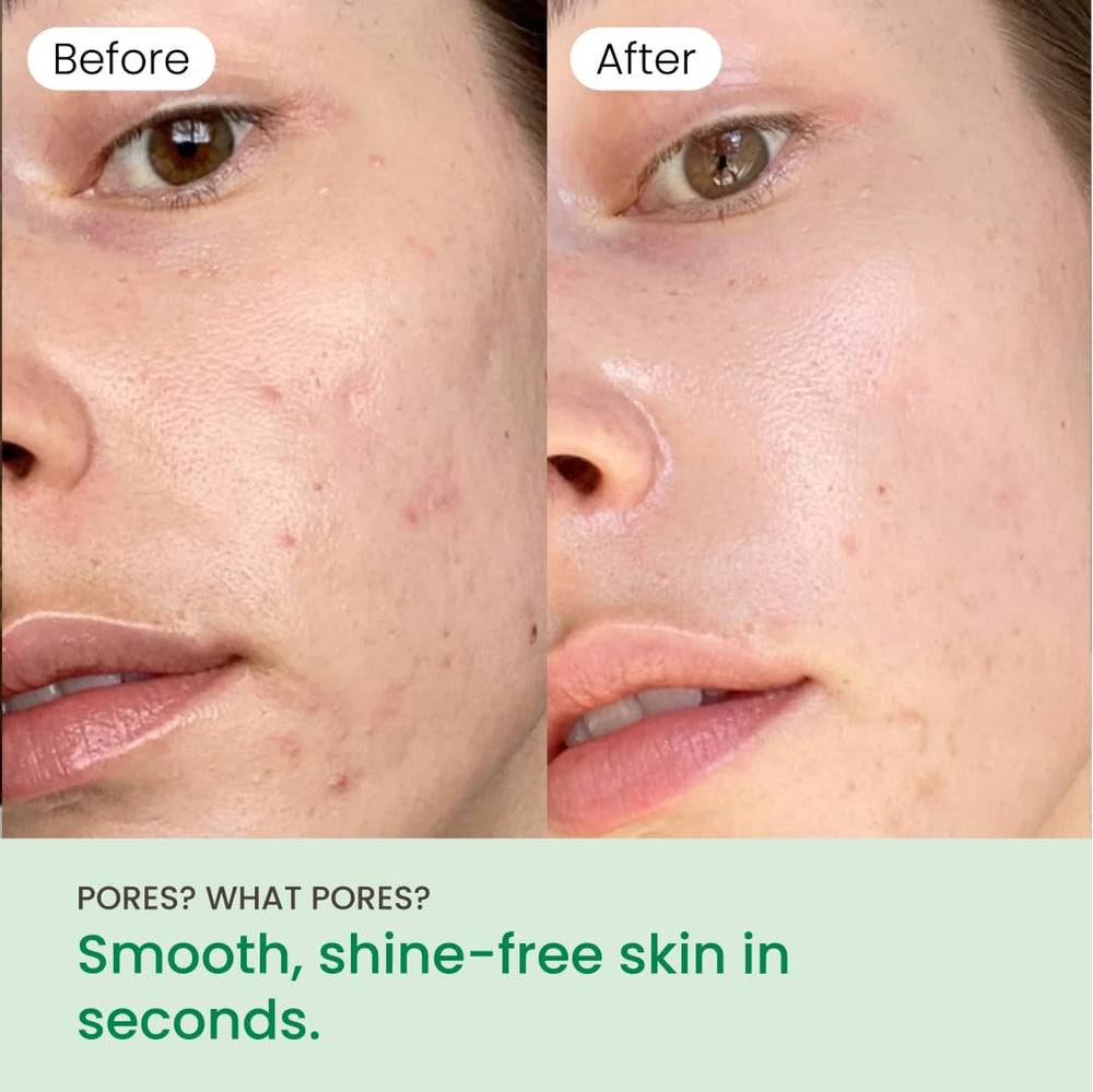 QUIA toner pads smooth side delivers hydration for dry areas and comfort.