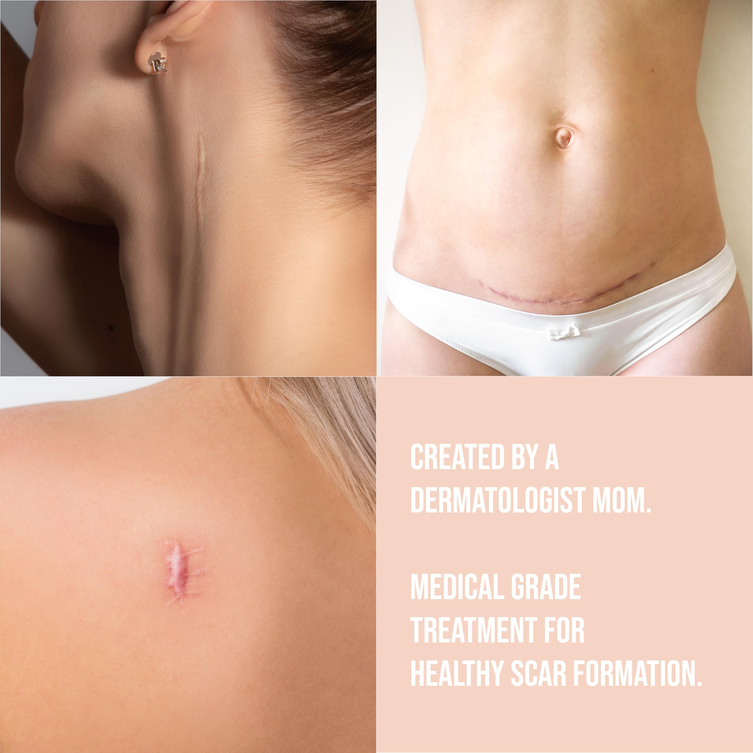 Quitch reusable silicone scar sheets for multi-day use.