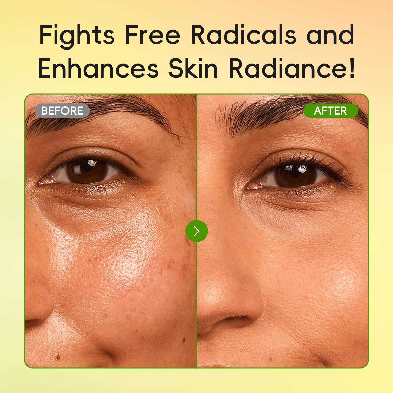 QUIYUM Skin Care Set box front showing the 5-piece kit for oily skin.