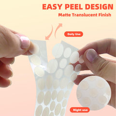 Hydrocolloid patch absorbs impurities while protecting the treated area.