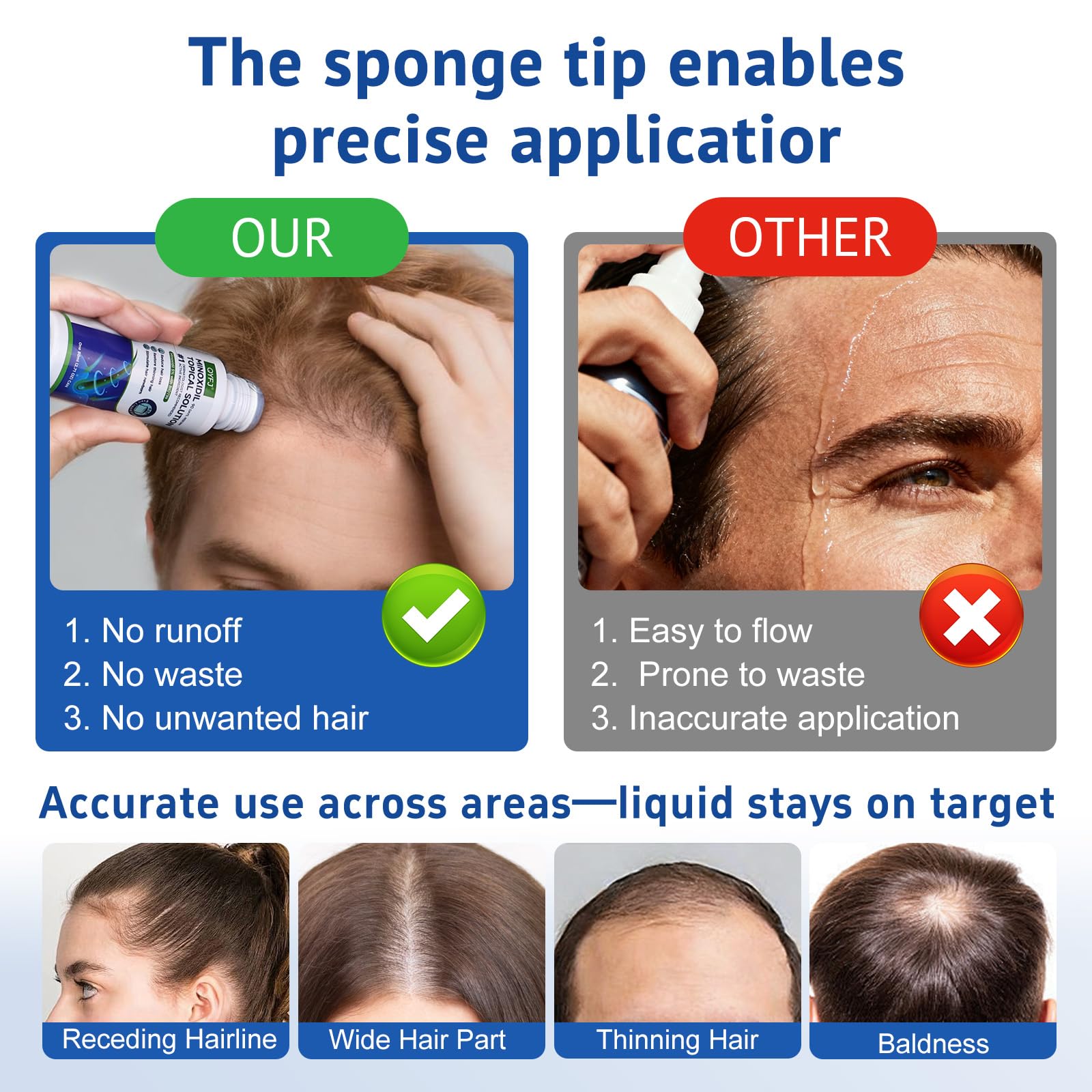 QYFJ sponge applicator close-up demonstrates no-drip, targeted scalp coverage.