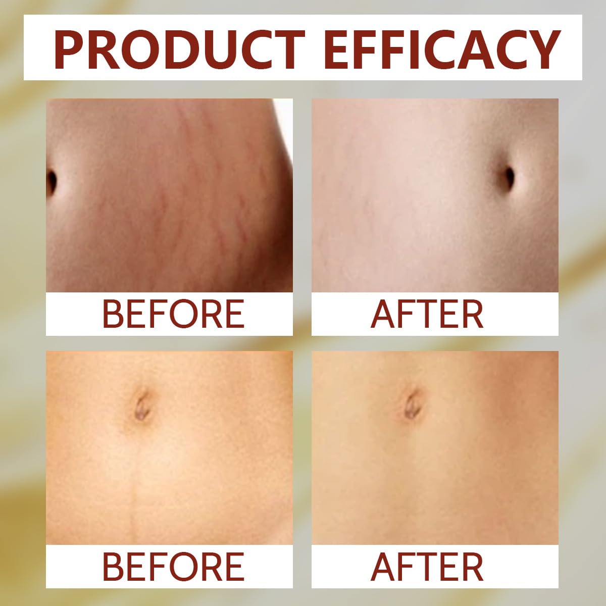 QYGCHUSIN buttocks firming focus suggesting contour refinement potential.