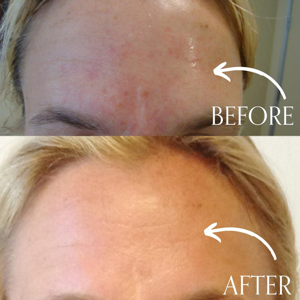 Radical Skincare Age-Defying Exfoliating Pads eye-lip-area-use illustrates gentle, comprehensive coverage