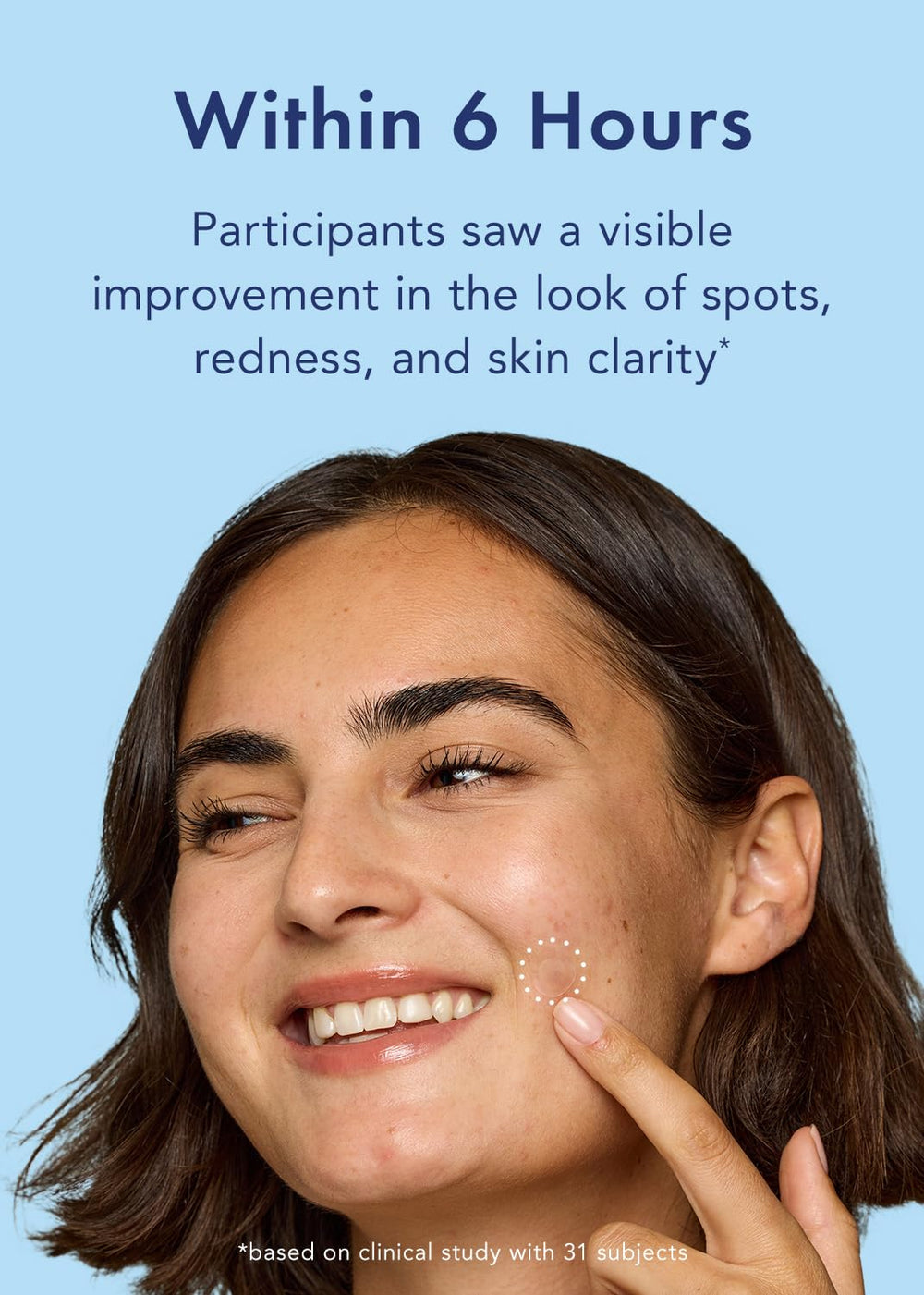 Rael night-time skin care supports gentle treatment with hydrocolloid technology.