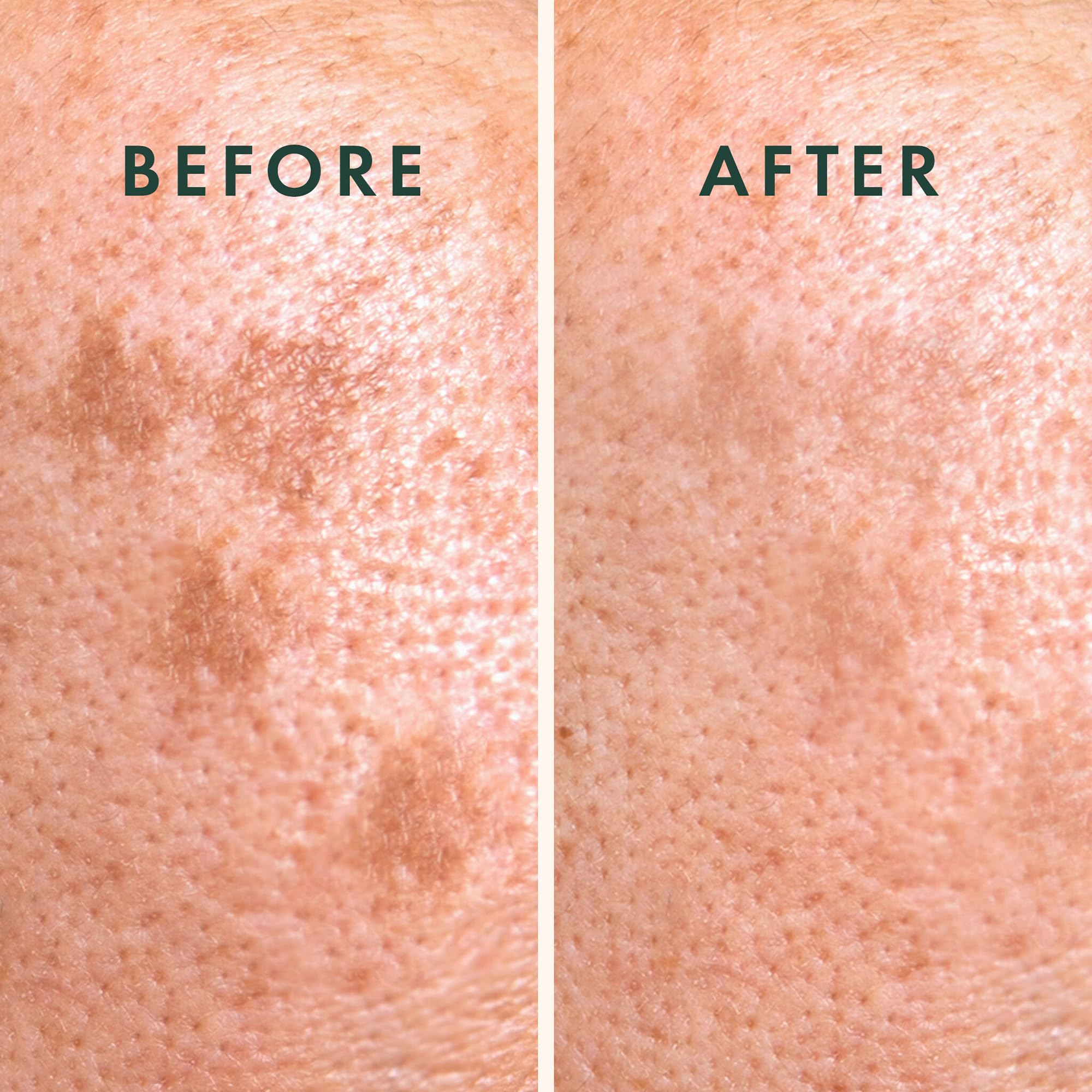 Rael Pimple Patches shield blemishes from irritants while healing.