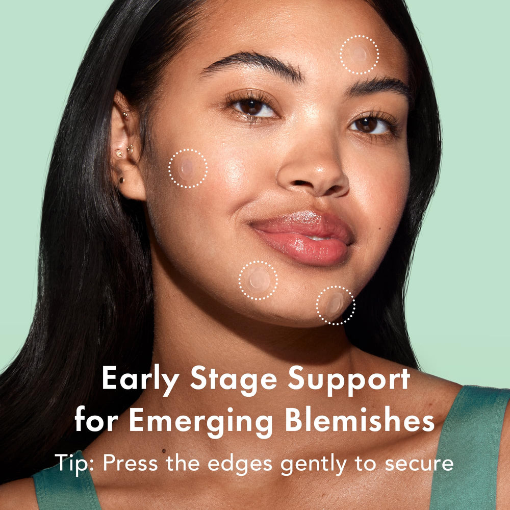 Rael Pimple Patches with willow bark extract for natural blemish support.