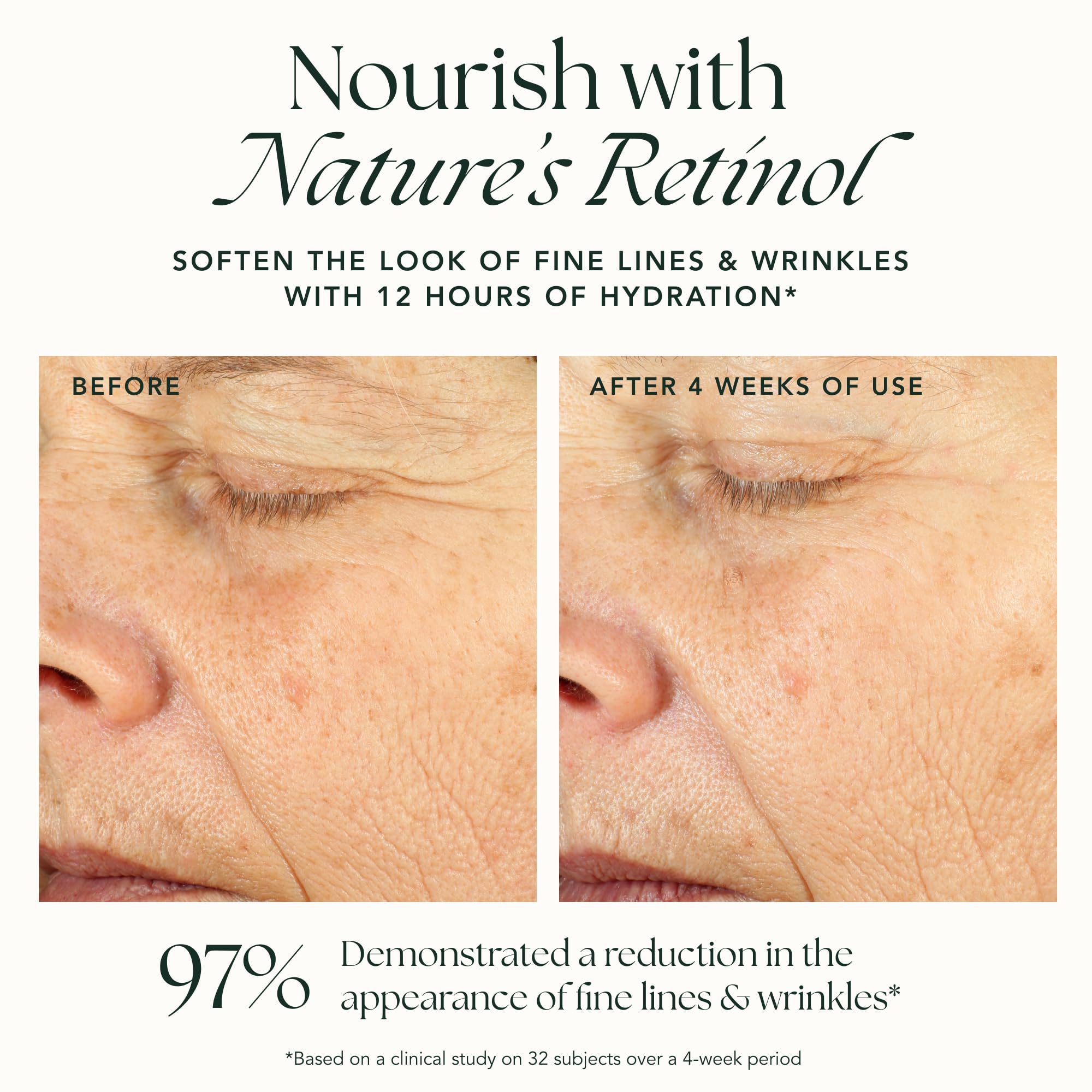 RANAV Ashwagandha adaptogen ingredient supports calm, resilient skin