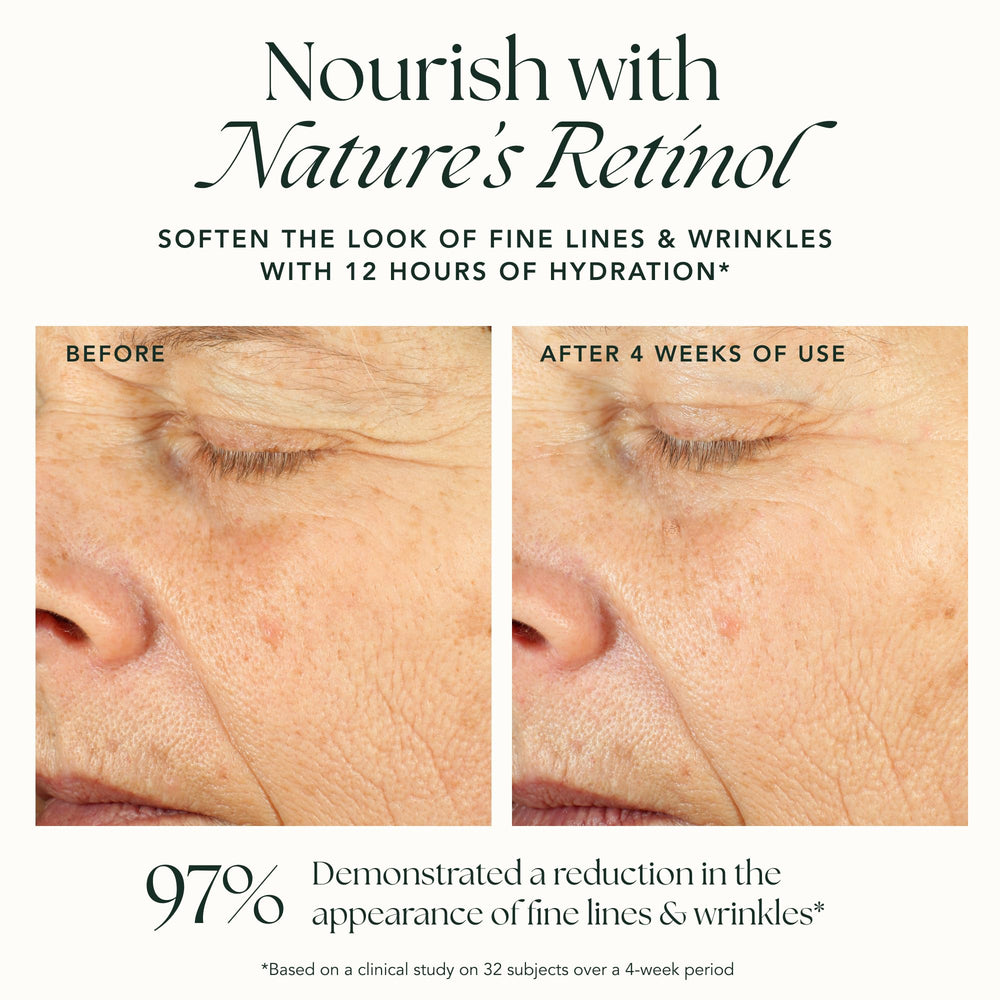 RANAV Ashwagandha adaptogen ingredient supports calm, resilient skin
