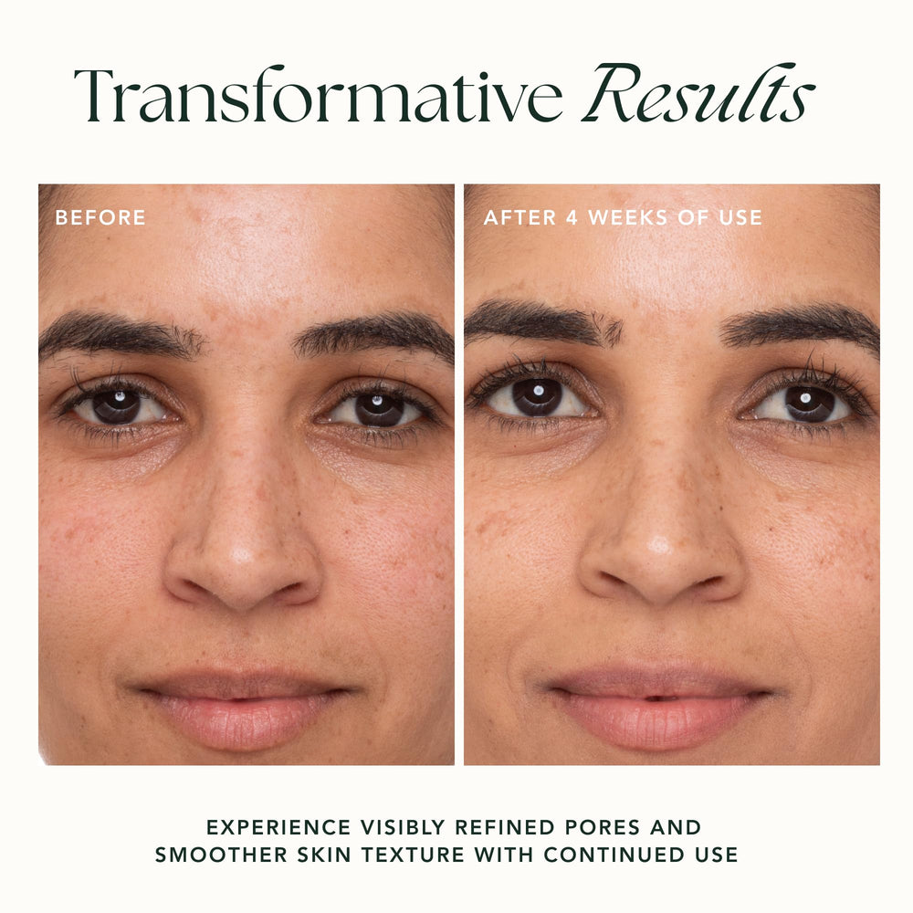 RANAVAT BOTANICS Refining Lotus Gel Cream swirls demonstrating hydration and subtle radiance.