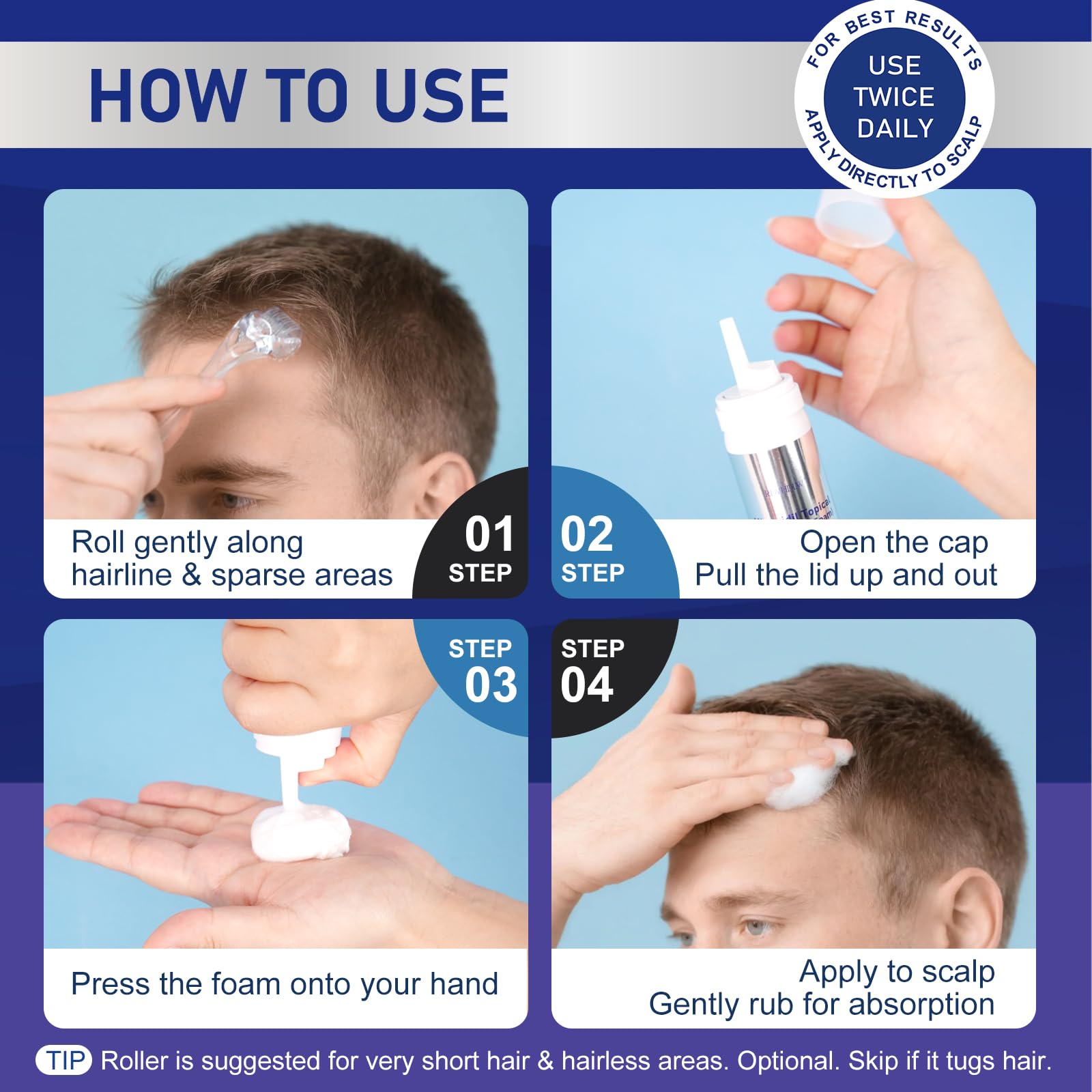 RDVHDLW Minoxidil Foam sur le cuir chevelu pour nourrir les follicules