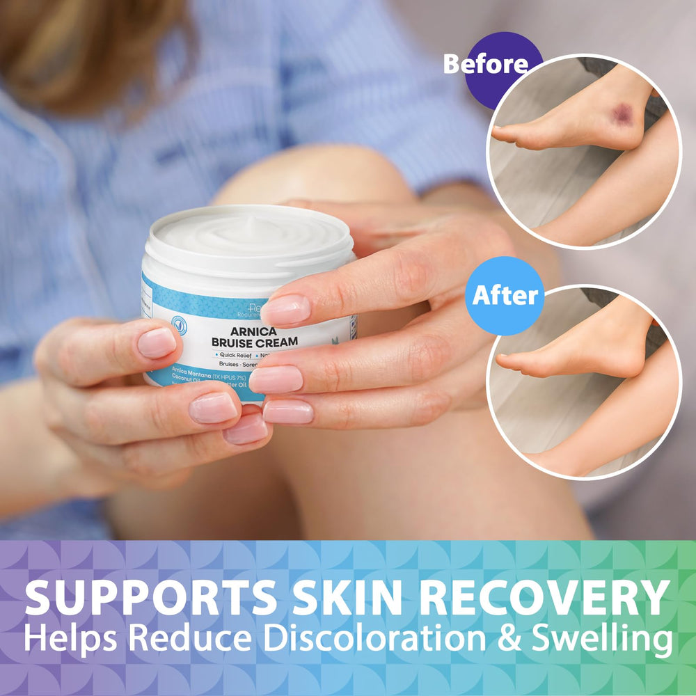 Recuren Plus Arnica Bruise Cream ingredients: Vitamin K1, coconut oil, shea butter