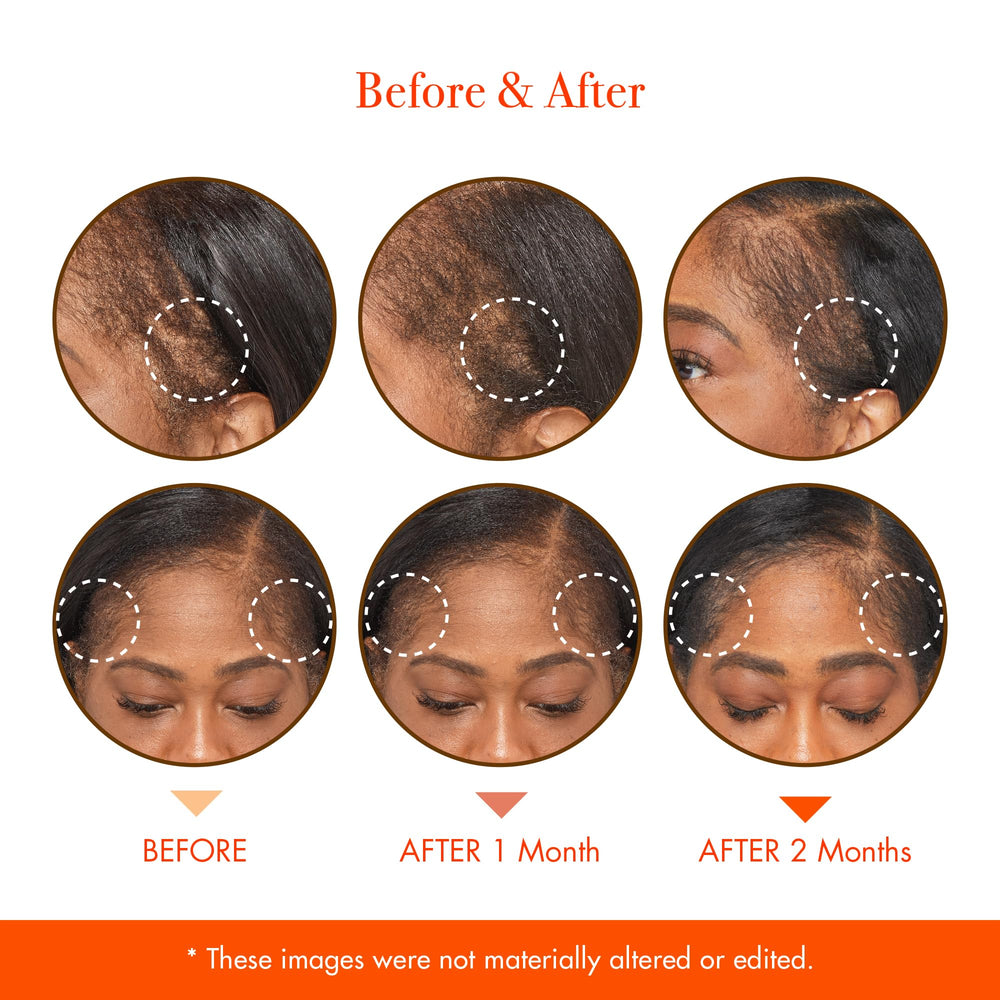 Red by Kiss Growth MD daily-use routine supports consistent care.