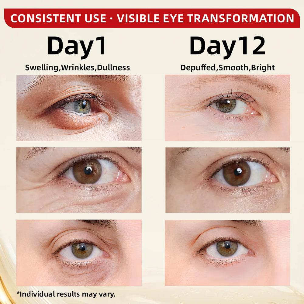Redcool application point shows hydration and smoother eye area potential