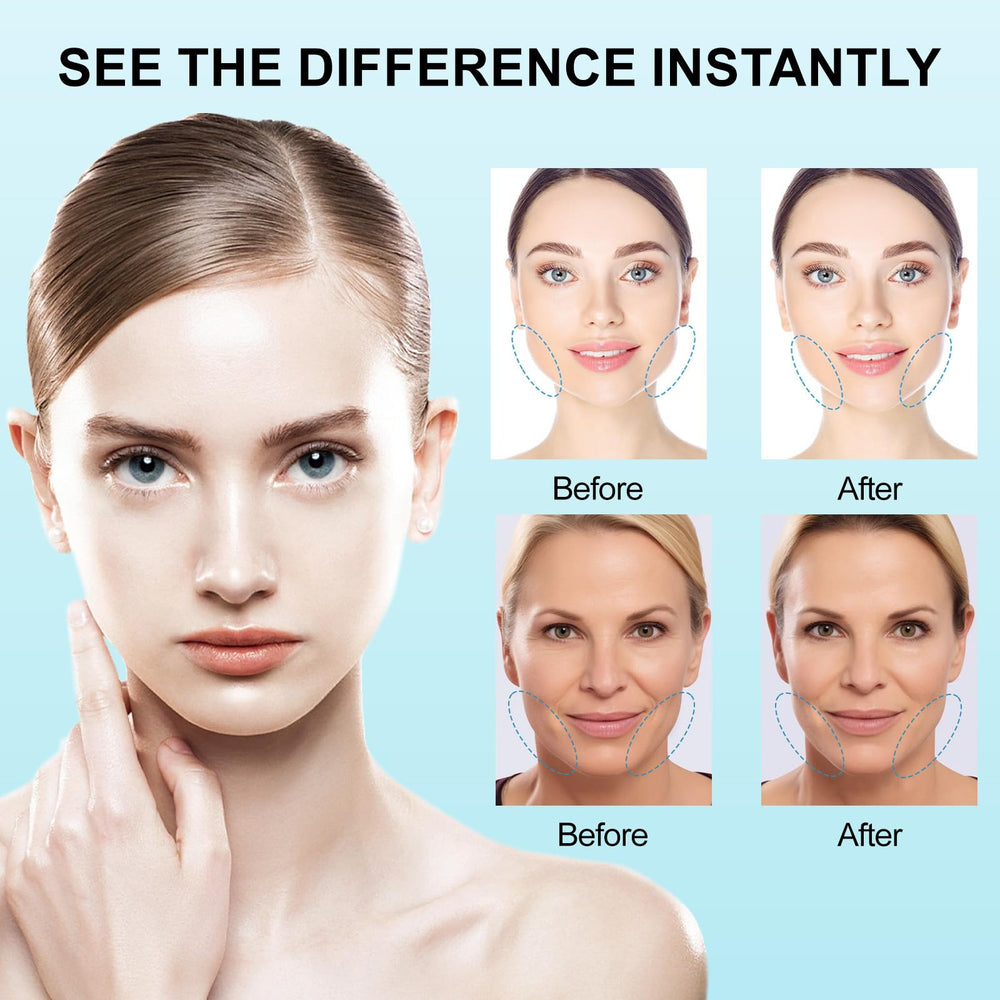 Redcool jawline contour lift enhances cheeks and jaw for definition