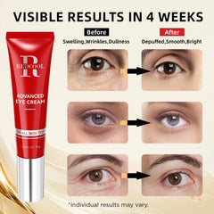 Redcool Retinol Eye Cream under eye application demonstrates smooth, easy to apply care