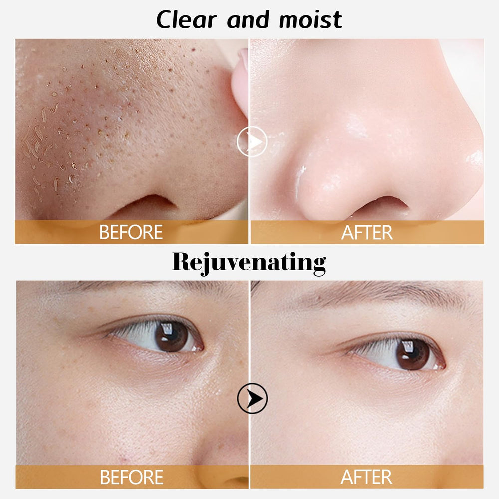 Rednow peel-off results reveal tightened appearance and clearer pores