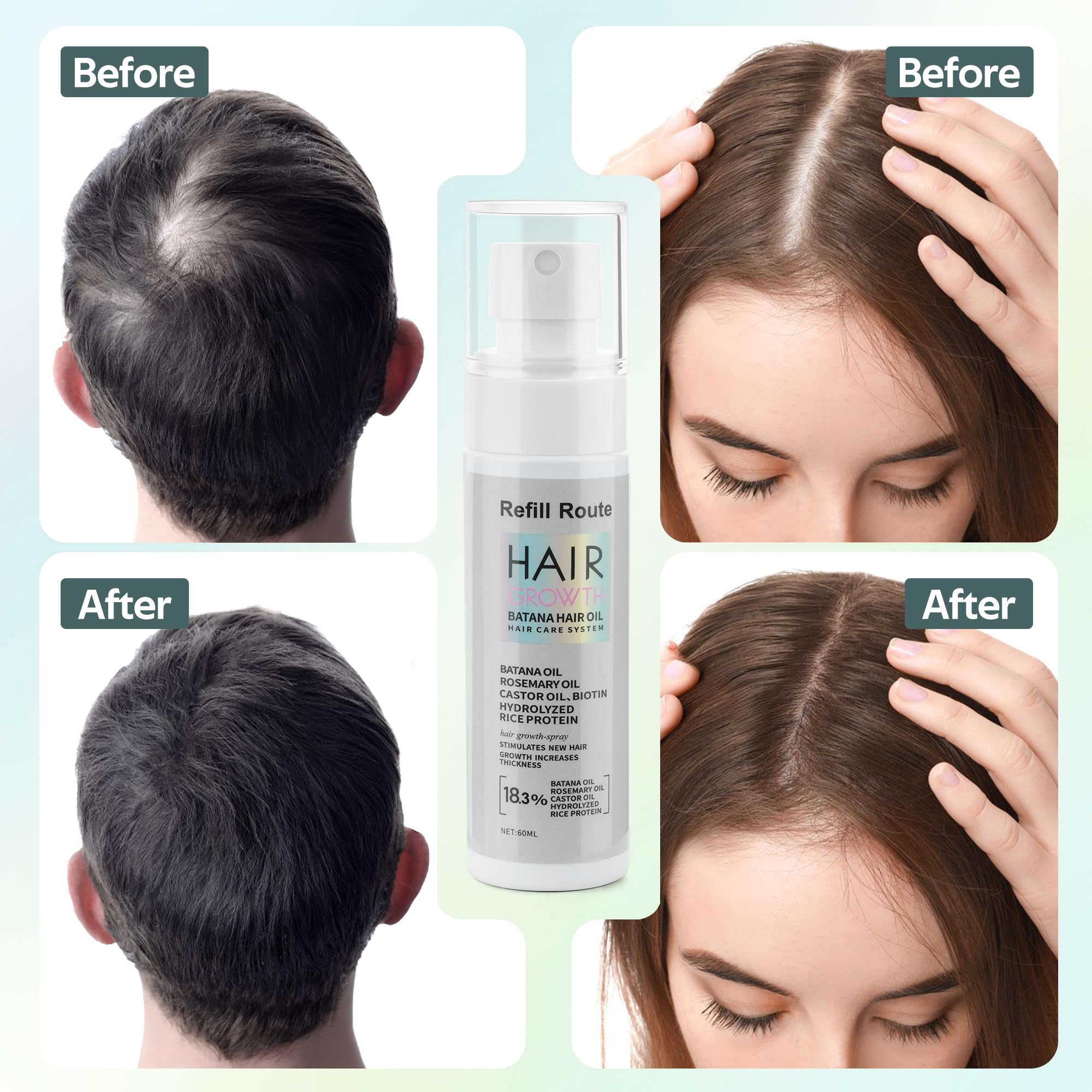 Applying Refill Route Batana Batana Oil Spray on scalp for nourishment