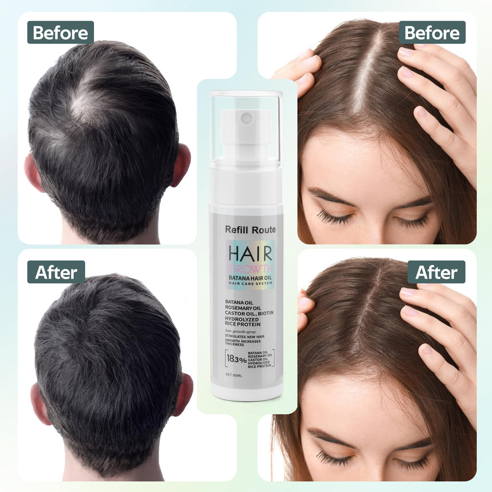 Applying Refill Route Batana Batana Oil Spray on scalp for nourishment