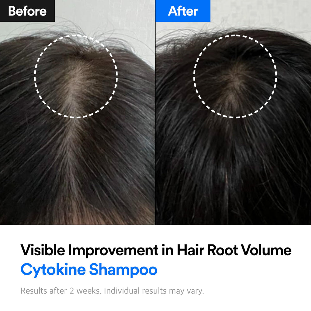 Refilled Hair-Recovery Cytokine Shampoo label closeup highlights NAADP and cADPR ingredients.