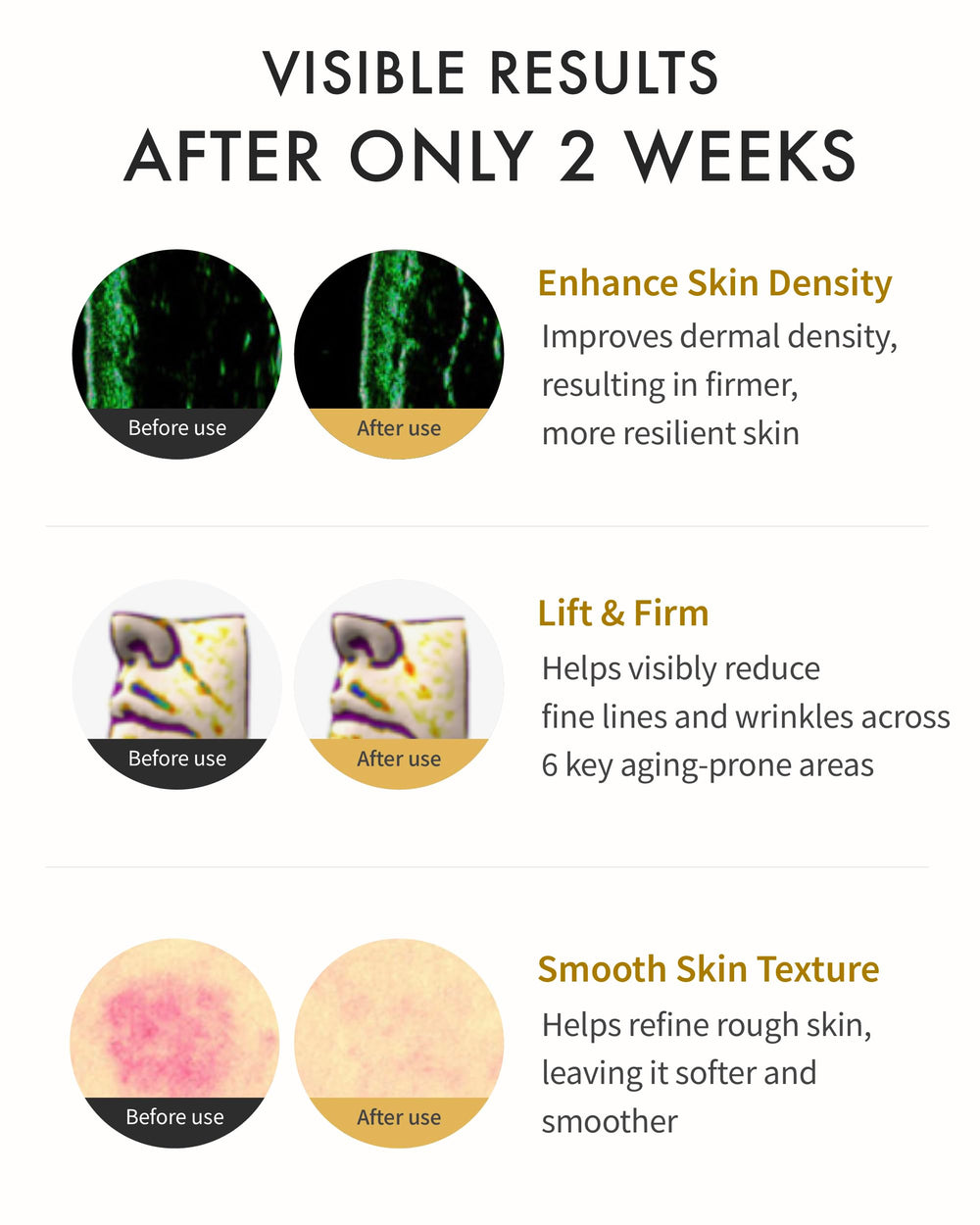REJURAN Dual Effect Ampoule elasticity-boost look suggests firmer, smoother skin texture.