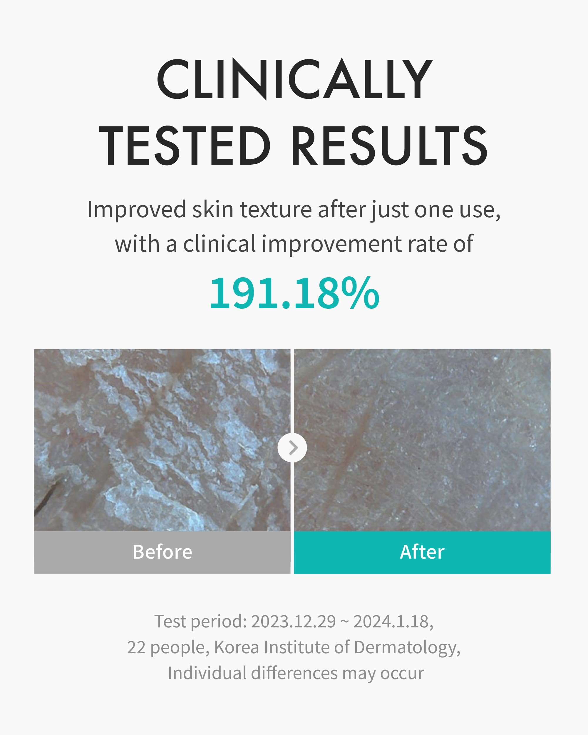 REJURAN PDRx Complex illustration emphasizes calming support for irritated dry skin.