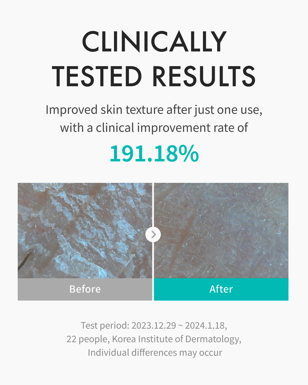 REJURAN PDRx Complex illustration emphasizes calming support for irritated dry skin.